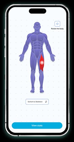 physio_mobile_2_mockup